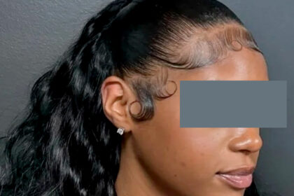 Jamaica’s Education Minister Responds After Ban on ‘Baby Hair Edges’ in School Triggers National Debate